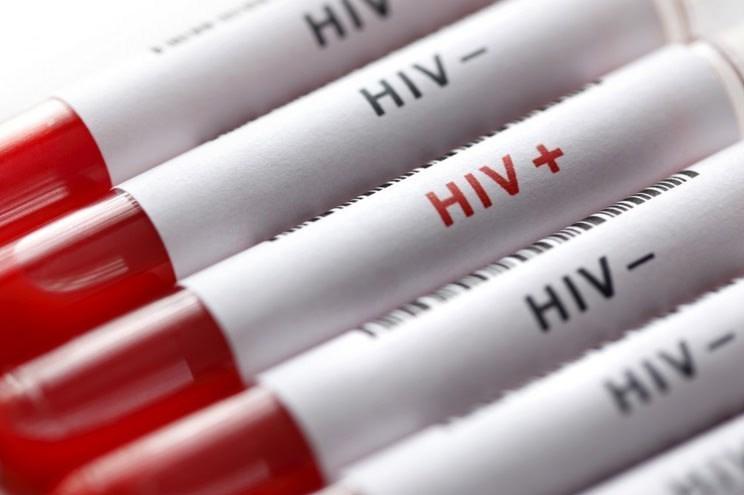 شناسایی ۲۵۰۰۰ مبتلا به HIV در ایران؛ آشنایی با راه‌های پیشگیری و درمان رایگان ایدز