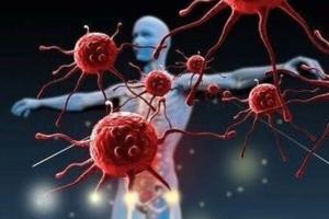 نیمی از مردم از علائم سرطان بی‌خبرند؛ اهمیت مشارکت عمومی در پیشگیری و تشخیص زودهنگام